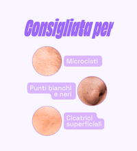 Consigliata per Microcisti, Punti bianchi e neri, Cicatrici superficiali - Retinolo & Vitamina E - Night Cream - 1 mese gratis